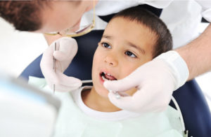 tooth colored fillings for kids