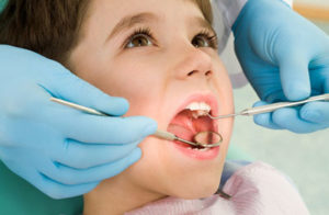 dental cleanings and exams kids dentistry shreveport